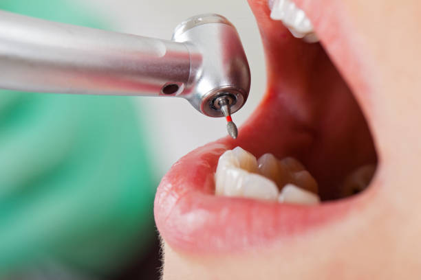 Best Knocked-Out Tooth Emergency  in St Robert, MO